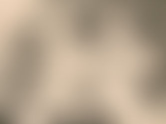 Treat Diabetes as a Friend!