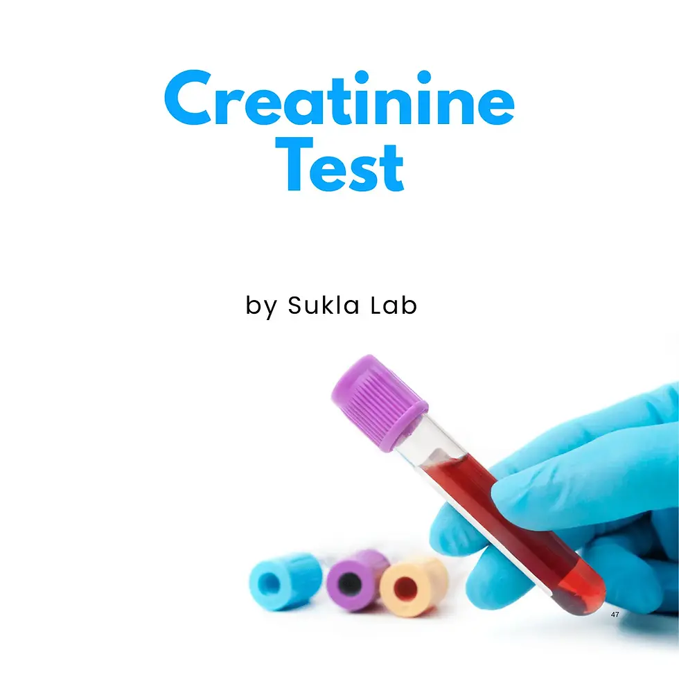 Creatinine Test