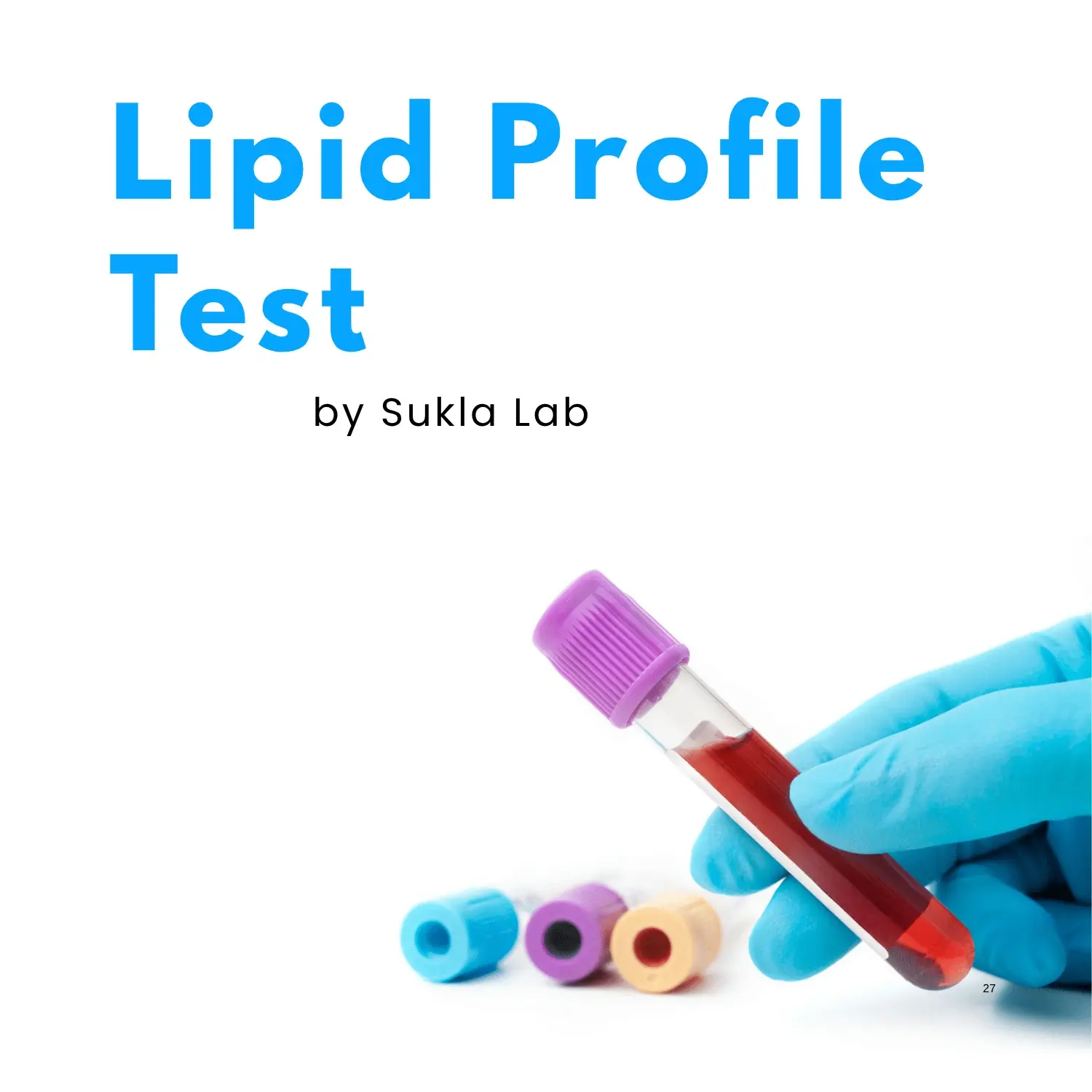 Lipid Profile Test