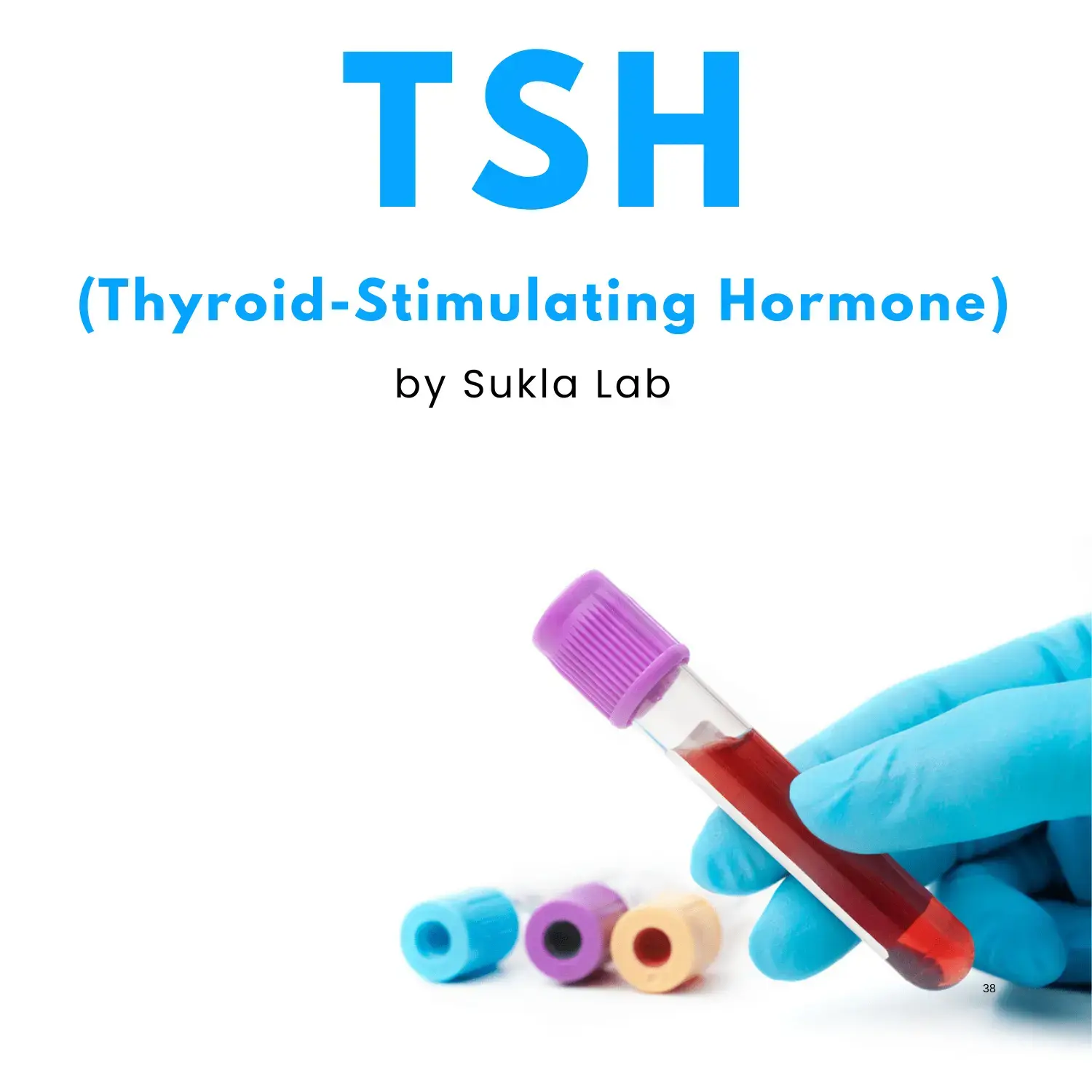 Thyroid-Stimulating Hormone - TSH