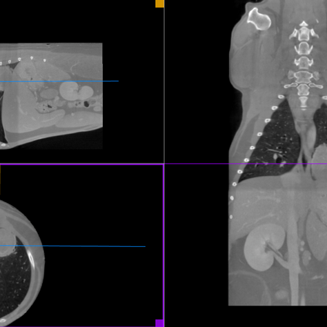 Diagnosing Lung Disease in Pets with CT