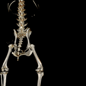 image_pelvis.png