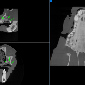 9.30.2020-bear-thick-mpr-view.png