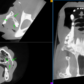 9.10.2020-bear-thick-mpr-view.png