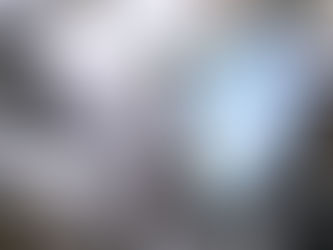 OCT (Tomografia a Coerenza Ottica): cos’è, quando serve e cosa possiamo vedere (macula e nervo ottico) – Agrigento