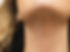 KMA Kybella