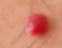 Large Blood Spot