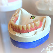 dentures%20on%20white%20scale%20rack_edi