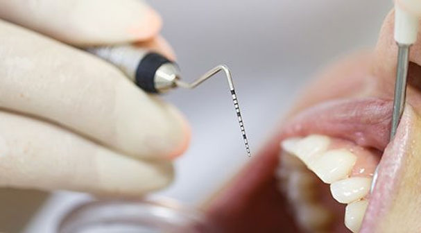 periodontal-treatment.jpg