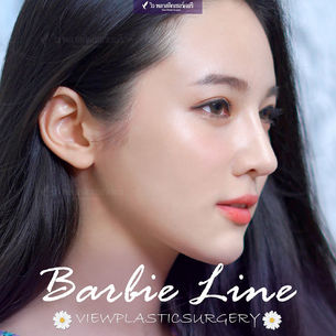 Rhinosplasty-ศัลยกรรมจมูก