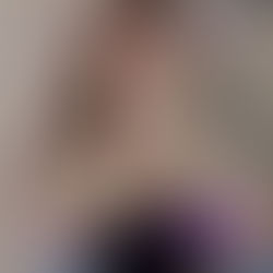 Breast Surgery - ศัลยกรรมหน้าอก