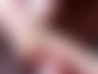 Onicomicose: o que é, quais os tipos de infecção e tratamentos? 