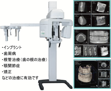 歯科用三次元CT