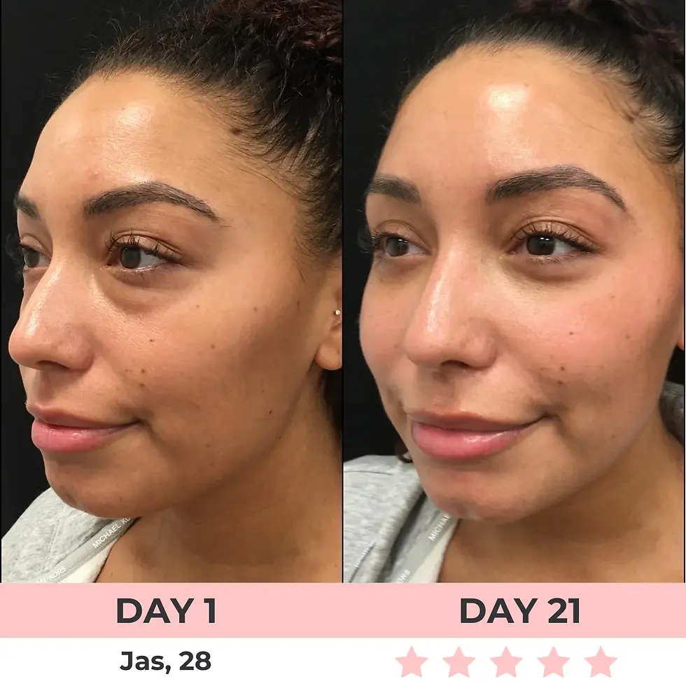 Thumbnail: RED LIGHT UNDER-EYE GLASSES