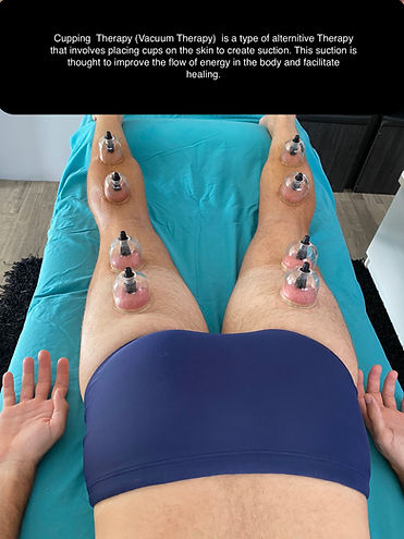 Cupping 1.jpeg