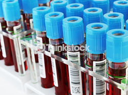 gettyimages-523184134-170667a