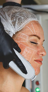 High-Intensity-Focused-Ultrasound-Treatment.jpg