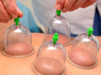 dry cupping