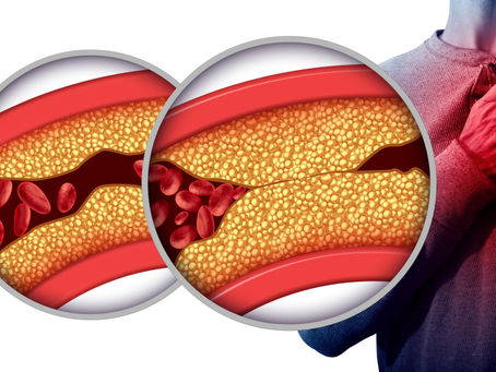 Health Facts Cardiovascular Disease