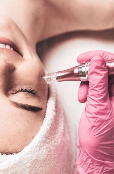 Microneedling
