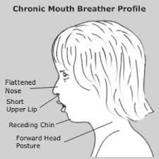 Mouther Breather Profile