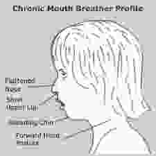 Mouther Breather Profile