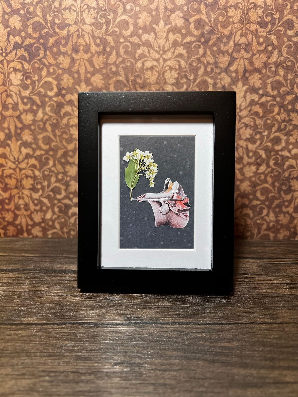 Thumbnail: Glossy Photo Print - Bladder or Prostate 04