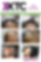 Hair and Scalp Consultation