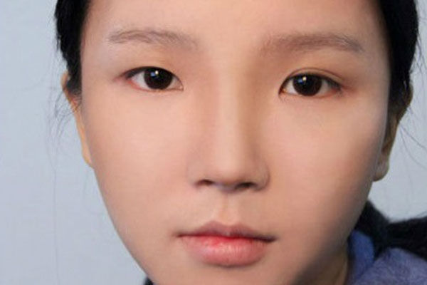 Thực hư chuyện bấm huyệt chữa sụp mí mắt