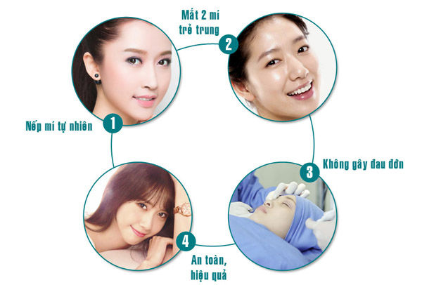 Top 3 lý do nhấn mí được yêu thích