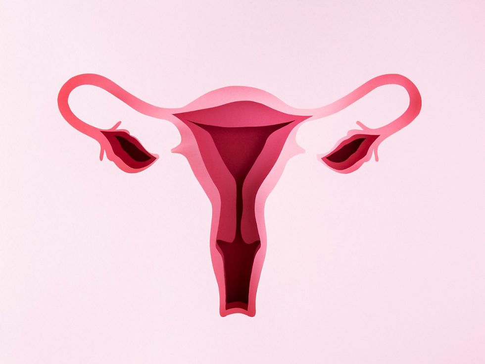 This is a medical illustration of a uterus and ovaries symbolizing PCOS, polycystic ovary syndrome, and treatment options provided by gynecologists at Miami Women’s Center
