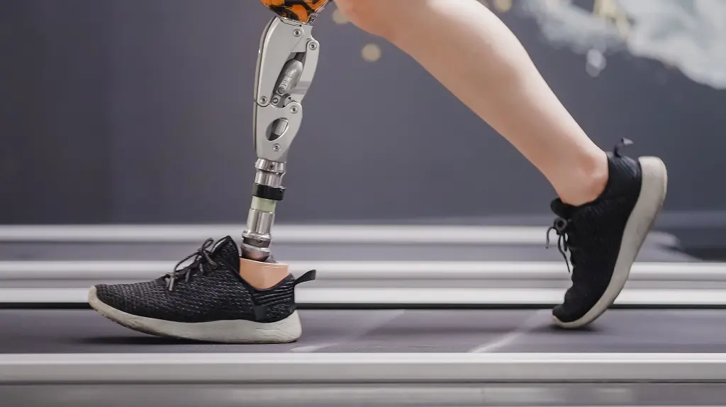 prosthetic leg.webp
