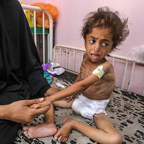 Recent image of a starving child in Gaza