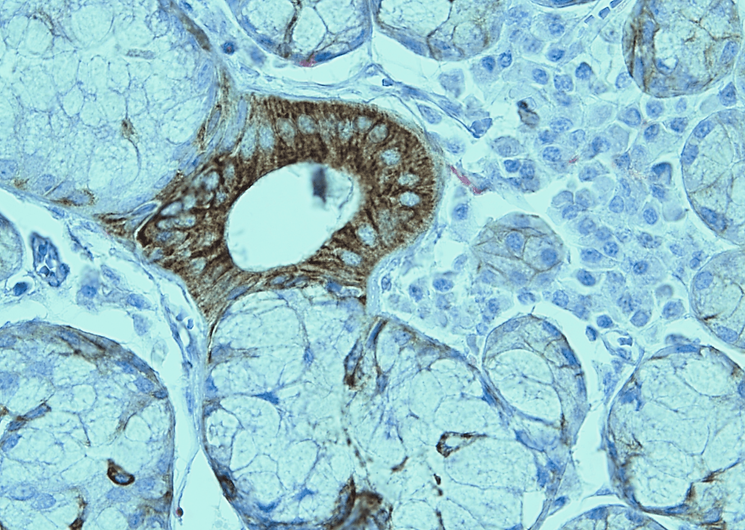 Double IHC2.png