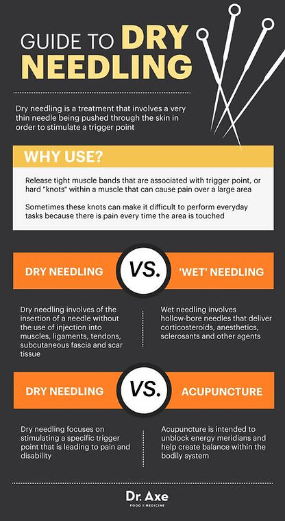Helton Chiropractic | Dry Needling / Acupuncture