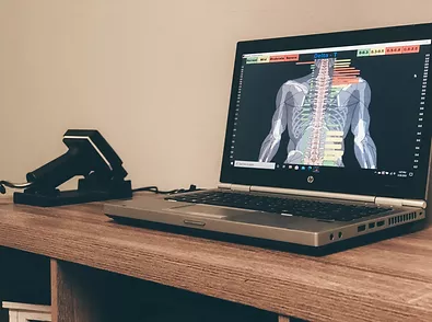 Tytron Theromography chiropractic