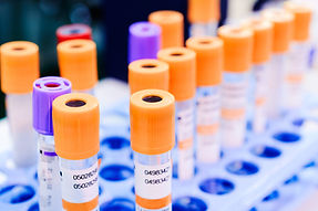 Pluristyx to Support Development of Kiadis’ K-NK Cell COVID-19 Therapy Funded by $9.5 Million From the Advanced Regenerative Manufacturing Institute’s BioFabUSA Program