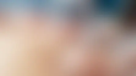 Dr. Bekir Hucuptan - Steril klinik ortamında tıbbi kupa terapi hacamat uygulaması