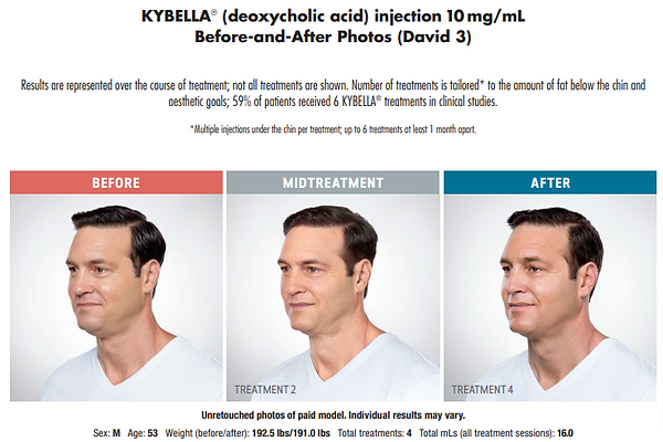 KYB114184-v2_Bea (2).png