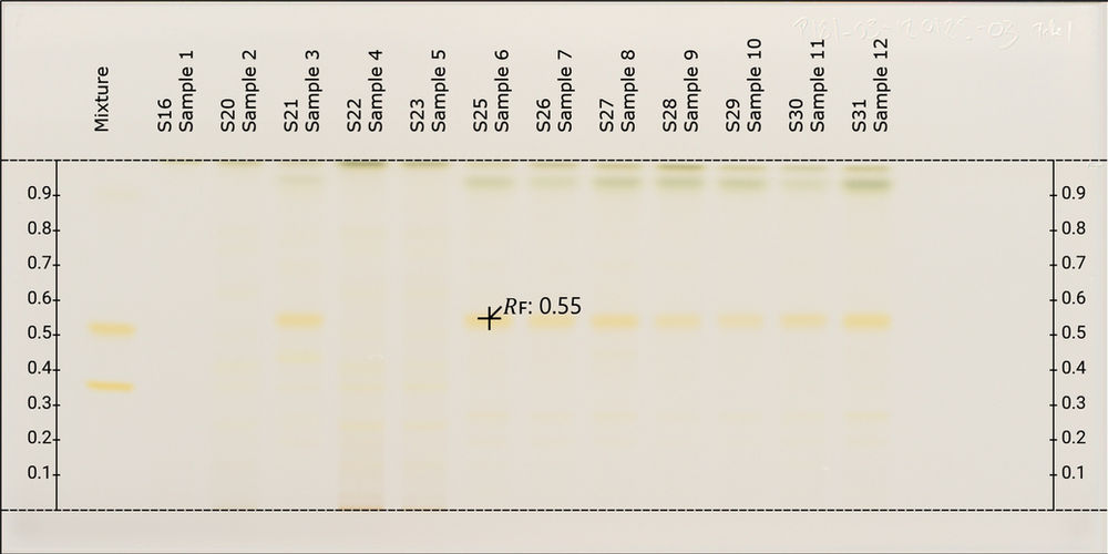 How do you document your TLC plates?