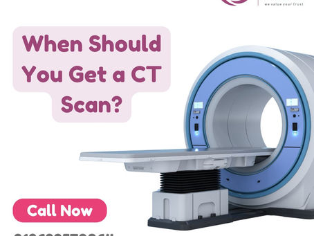 When Should You Get a CT Scan?