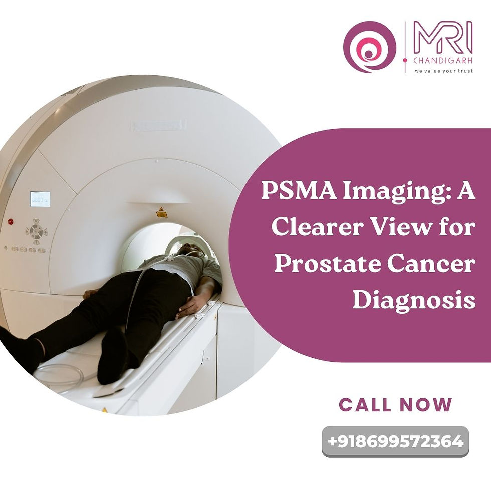 PSMA Imaging: A Clearer View for Prostate Cancer Diagnosis