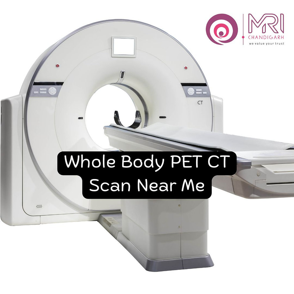 Full Body CT Scan Near Me Explained in a Nutshell