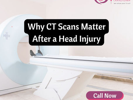 Why CT Scans Matter After a Head Injury