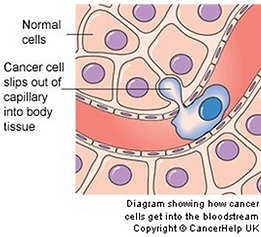 cancer treatment singapore, heat therapy singapore, hyperthermia treatment singapore, oxygen therapy singapore, side effects of cancer singapore