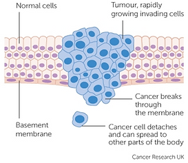 cancer treatment singapore, heat therapy singapore, hyperthermia treatment singapore, oxygen therapy singapore, side effects of cancer singapore