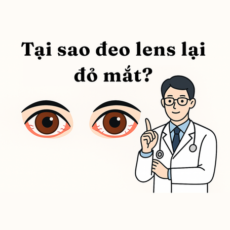 Tại sao đeo lens lại bị đỏ mắt? Sự thật không phải ai cũng biết!