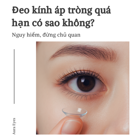 Đeo kính áp tròng quá hạn có sao không?
