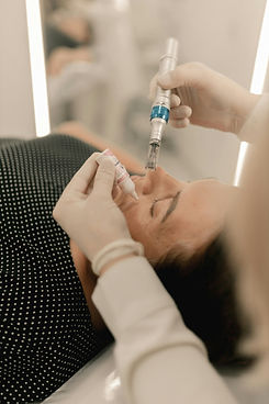 Microneedling.jpg
