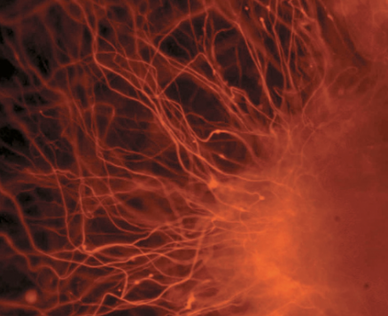 Neurons differentiated from embryonic stem cells. Image from: Nissim Benvenisty - Russo E. (2005) PLoS Biol 3(7): e234. doi:10.1371/journal.pbio.0030234 Creative Commons Attribution 4.0 license